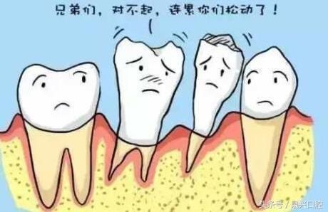 什么情况导致牙齿松动 t01676902684358af4c.jpg