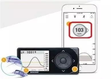 距离告别扎手指测血糖还有多远?快来围观这