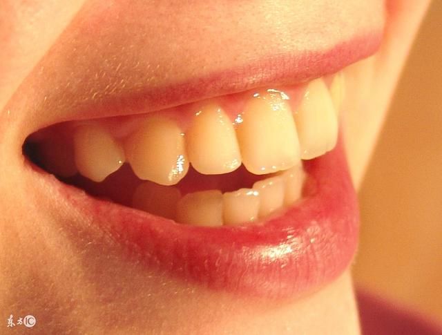 牙黄口臭太尴尬?教你牙齿变白、口气清新的绝