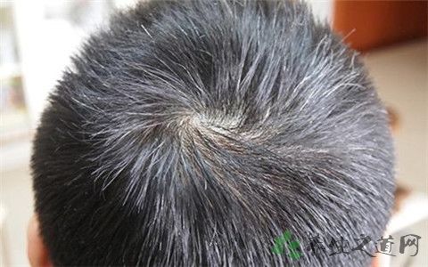 结肠腺癌怎么治疗