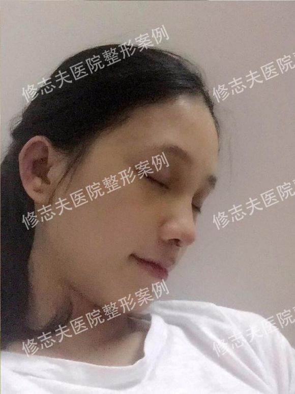 一个关于消灭塌鼻梁的故事,改变气质就辣么简