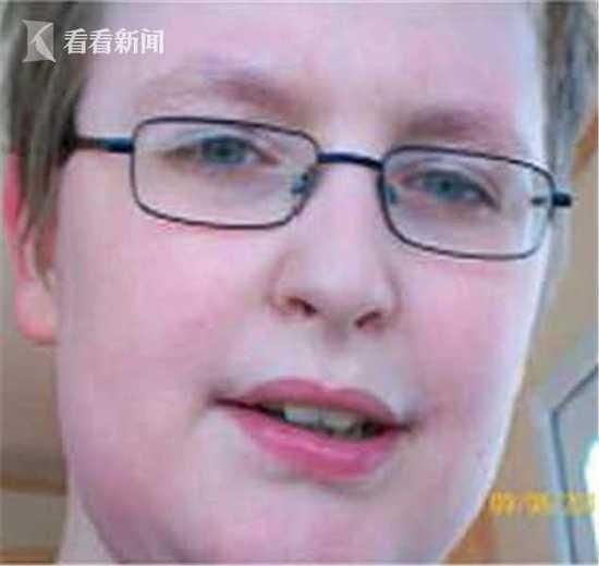 英国18岁少年被亲妈饿死 严重营养不良瘦到皮包骨