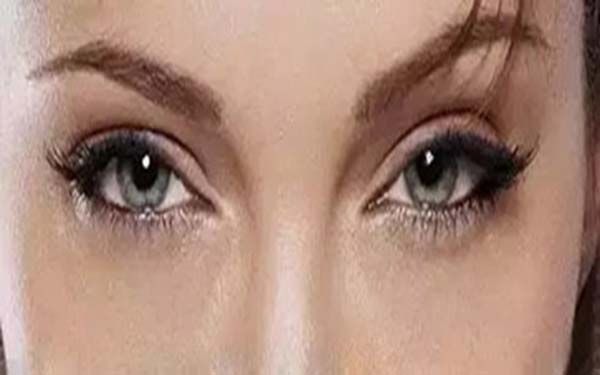 去眼袋整容医院