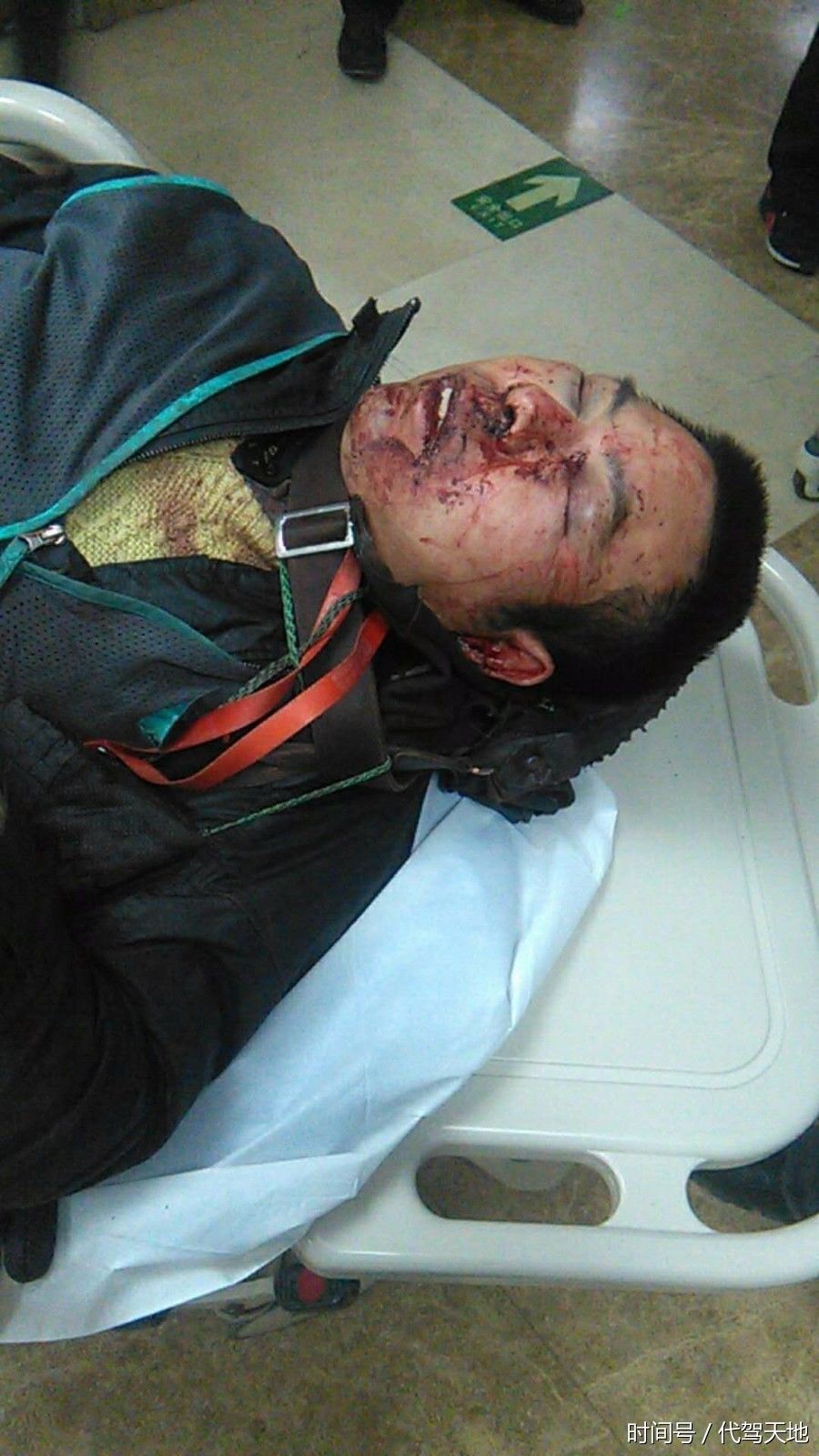 滴滴代驾师傅血染的代价