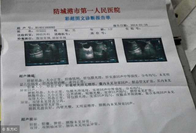 肺癌分期的TNM究竟代表啥？这下终于明白了！