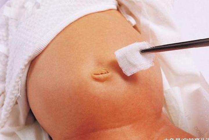 怎样才算正确的宝宝肚脐护理呢? 这些常识很重