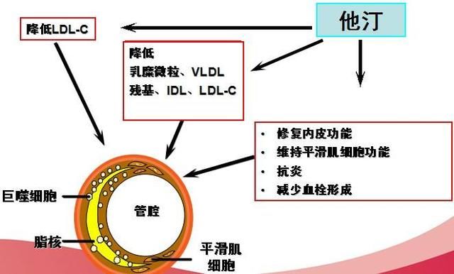 他汀类药物主要副作用及出现那些不适症状需要