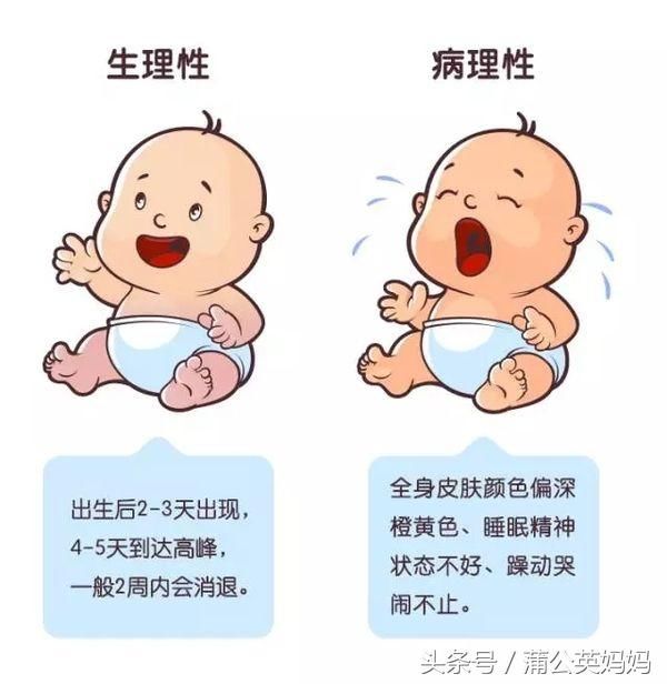 新生宝宝患母乳型黄疸，如何辨别？妈妈的母乳还要继续吗。