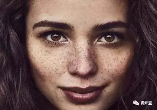 斑点肌肤预防扩散