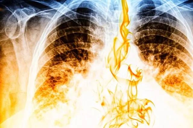 这种癌症死亡率第一!再不注意这些生活细节就晚了