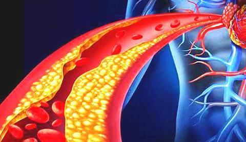 “它”是甘油三酯高的“克星”，常吃告别高血脂，让血管一通到底