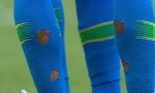 球迷们别担心!世界杯上内马尔球袜破洞,不是被