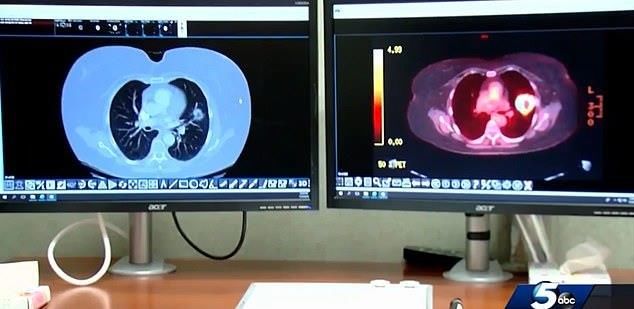 每日邮报报道:男子用狗药治疗肿瘤的故事