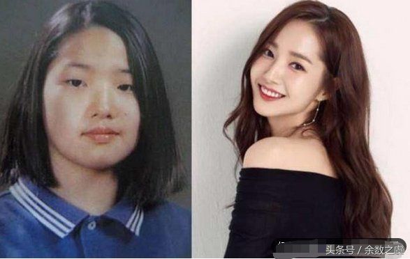 盘点韩国大方承认整形的7位女星,朴敏英整形太