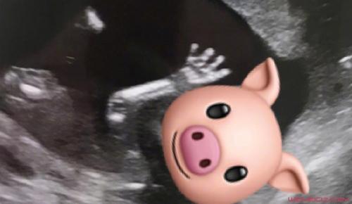 胡杏儿宣布二胎 胡杏儿晒二胎B超照怀孕几个月