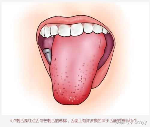 舌头泄露的身体秘密,看看中医舌诊