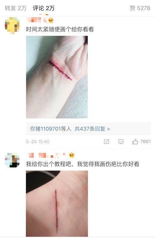 蔡徐坤又中招了！黑子冒充粉丝直播假割腕，这是什么仇什么怨？