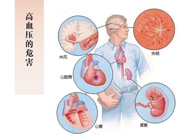 控制高血压，不要完全依赖降压药，最好的“降压医生”是自己！