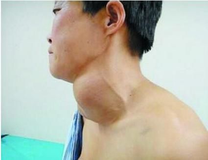 豆腐竟成男人死对头,常吃可让身体这一器官严