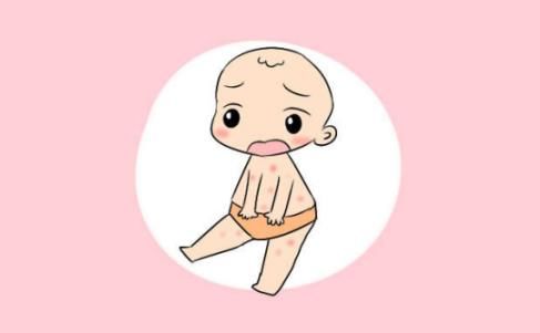 什么是婴儿湿疹,孩子湿疹怎么办