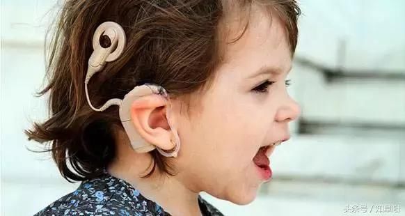 阜阳市首例成人人工耳蜗植入手术完成