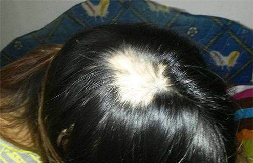 32岁美女产后用这类洗发水,头发一把一把掉,变