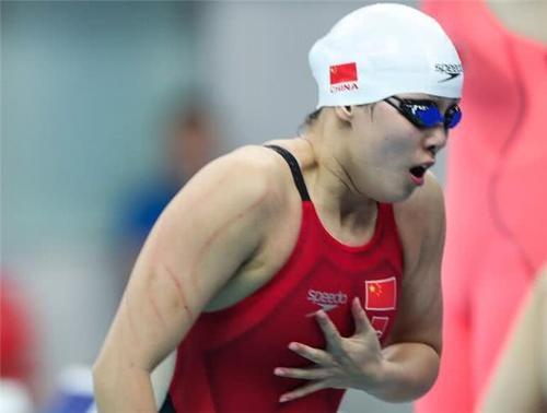 心疼!傅园慧赛前把身体抓破被骂在演戏,她委屈