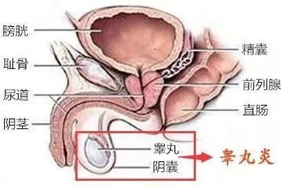 睾丸旁边长了一个小肉球,那是什么东西?