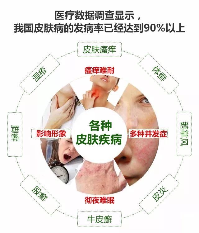 湿疹、顽癣等皮肤病久治不愈,行家教你一招轻松搞定,从此远离痒痛