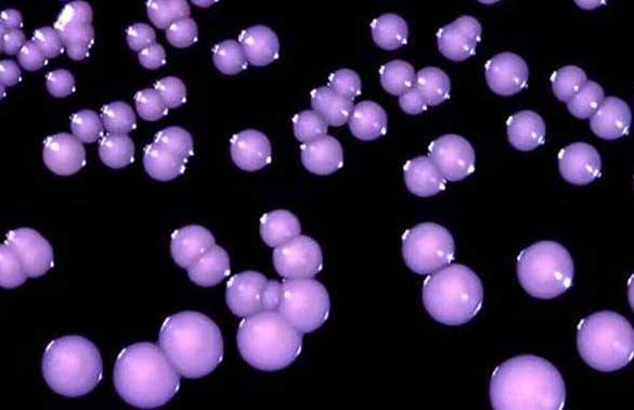 每天10人死于艾滋病,嘴巴出现3 特征 ,病毒已 蓄