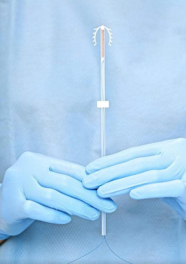 女人都害怕上环,这种避孕方式就真那么不好?