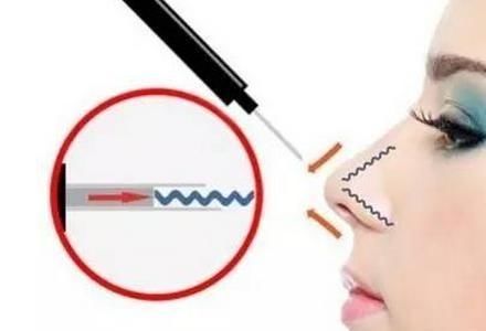 啥是线雕 t019820bffc9dc82356.jpg