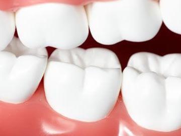 医生说牙髓炎严重需要做根管治疗, 根管治疗是