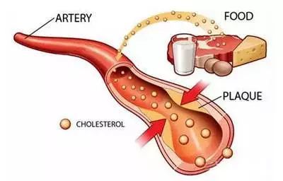 这几种食物让胆固醇直线上升，可惜你都喜欢!| 推广