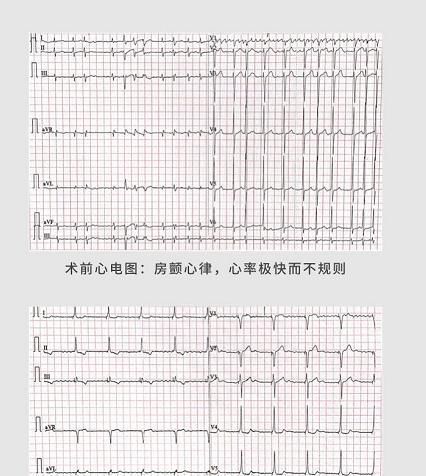 深圳今天跑马拉松吗