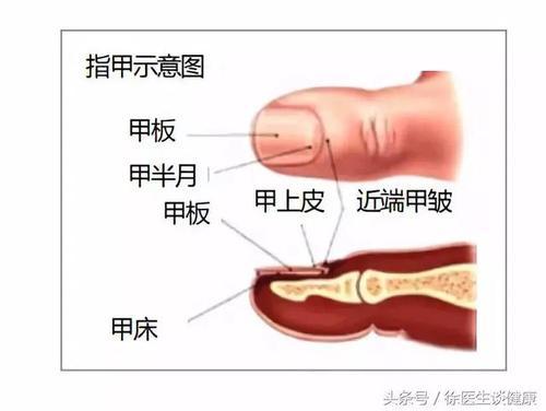 指甲不正常,问题可不小 出现这种情况,小心脑溢