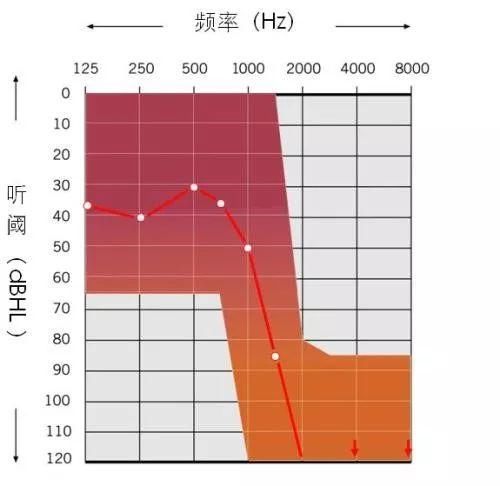 耳机我们听力的杀手