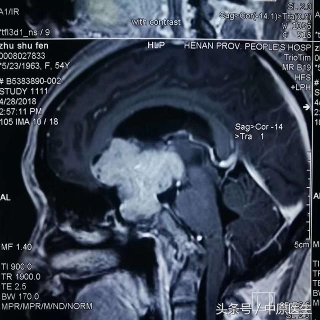 滕王阁很美，来南昌参加学术会议的专家却一直在反省做的三个手术