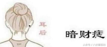 “此处”长痣的人，定是人中龙凤，大富大贵根本不是难事