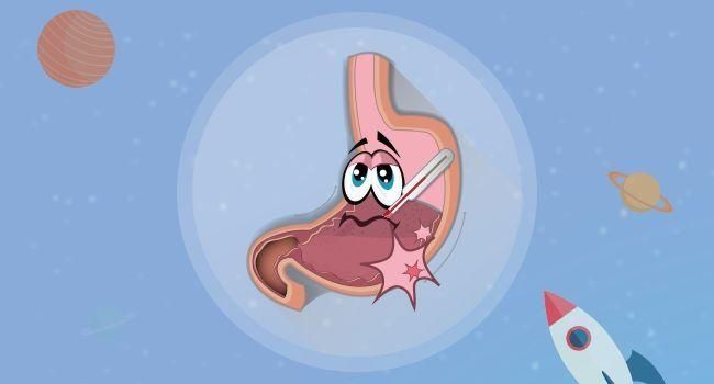 胃烧心 反复发作,饮食调理有五 不要 一 切记