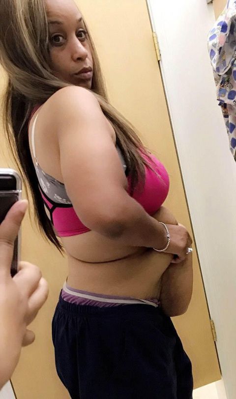 体重290斤的胖妞成功减肥150斤 肚子上却多出