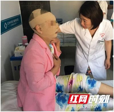 女子患白斑4年现遍布全脸 或因心理影响加重病情
