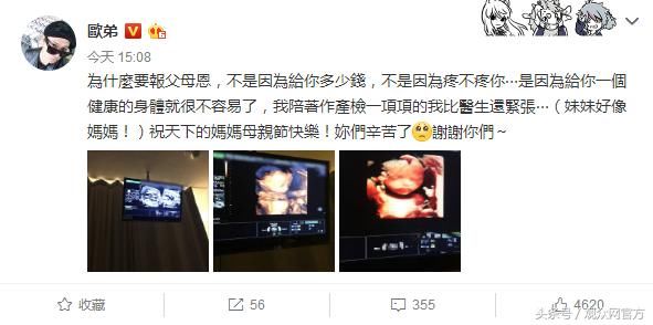 欧弟晒妻子二胎B超照 感慨比医生还紧张