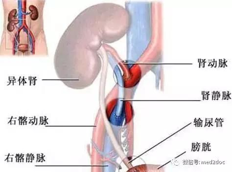 「这个医生很有趣」13个手术室里的冷知识：一个屁引发的血案！