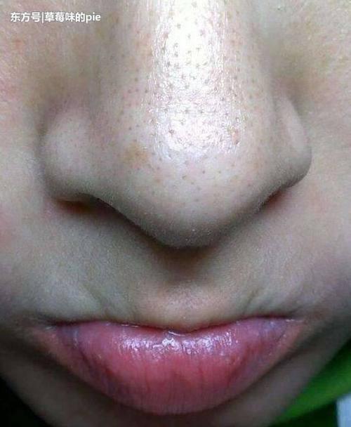 毛孔里的小颗粒怎么都挤不完,只要碰上这3物,