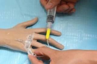 留置针封管时巨疼,这才是正确的封管感受!