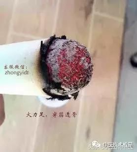 为什么有人刮痧不出痧?