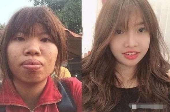 越南美女因太丑被男友抛弃，整容成美女后被富豪狂追，如今怎样？