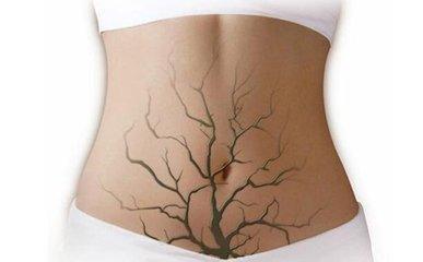 入伏后，出现4大症状，说明体内毒素多，简单3招，给身体排排毒