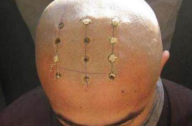 雍正规定僧人头顶烧戒疤,原来是有这样的意